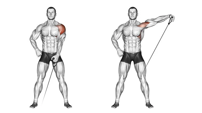 Laterales con cable unilateral